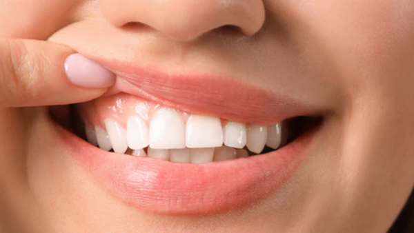 Hausmittel bei Parodontitis: Mit Mikronährstoffen das Zahnfleisch unterstützen